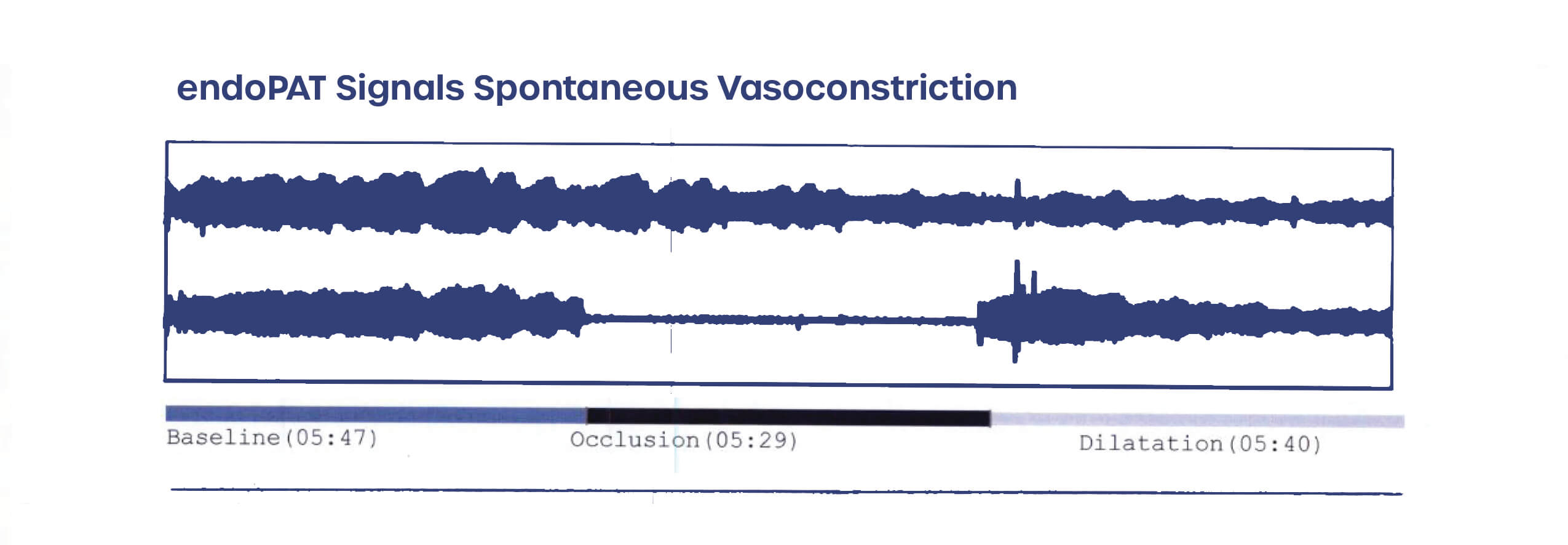 Endopat Test Locations : Endothelial Function Test – DYHZ